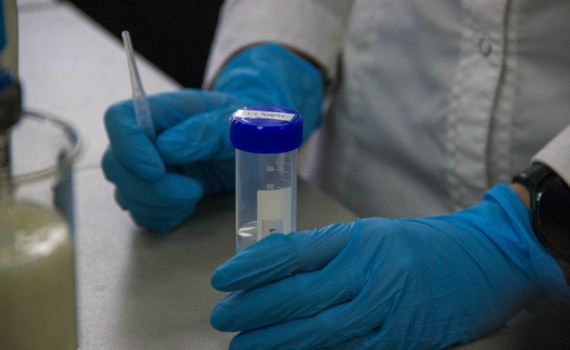 Роспотребнадзор отслеживает ситуацию с распространением неизвестного заболевания в Конго